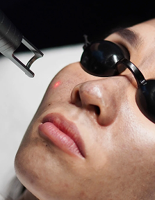 Glow Aerolase Facial